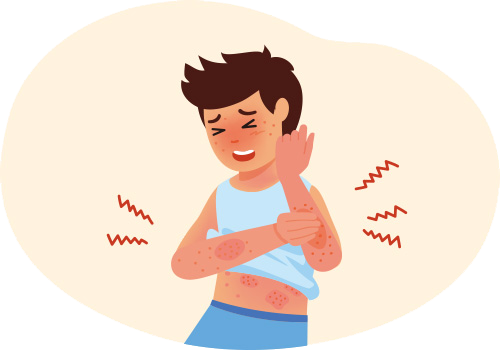 身体を搔く男の子のイラスト