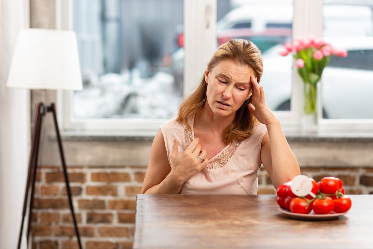 Headache and rash. Mature woman having headache and rash on skin after eating tomatoes because of allergy