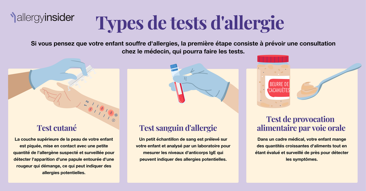 Types of allergy testing