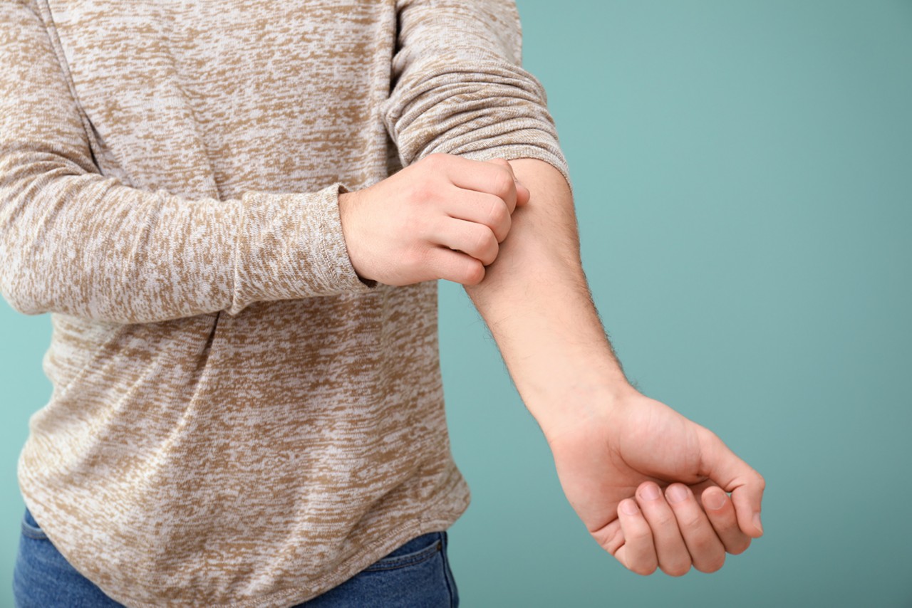 Young man with skin allergy on color background; Shutterstock ID 1466307215; Purchase Order: JanFeb Social Images