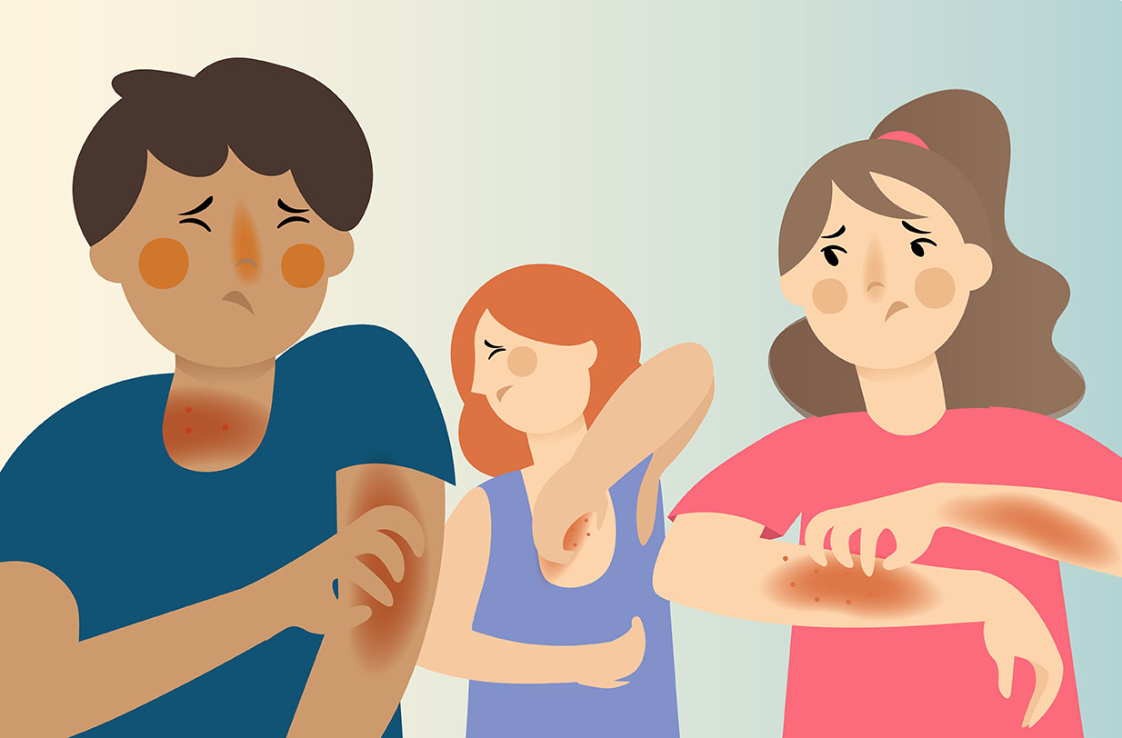 An illustration of several adults suffering and itching from skin allergies.