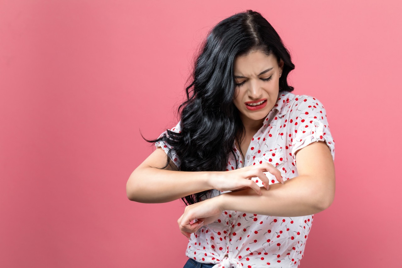 Young woman scratching her itchy arm. Skin problem.; Shutterstock ID 1169648437; Purchase Order: December Social Images; Job: IDD social media 