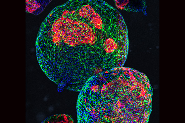 Cardiac organoids grown from induced pluripotent stem cells (iPSC) to model heart physiology in 3D models.