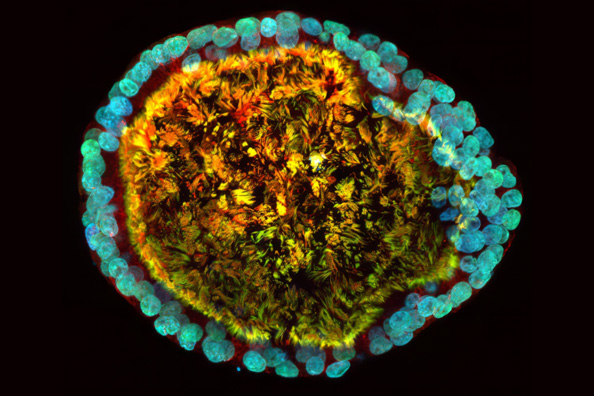 Multiplexed, spatial immuno-flourescence imaging of a lab-grown lung organoid stem cell model that enables researchers to better understand and treat rare congenital lung diseases.